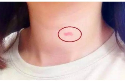 如何种植草莓籽