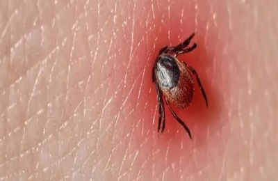 家里有蜱虫用什么杀虫剂